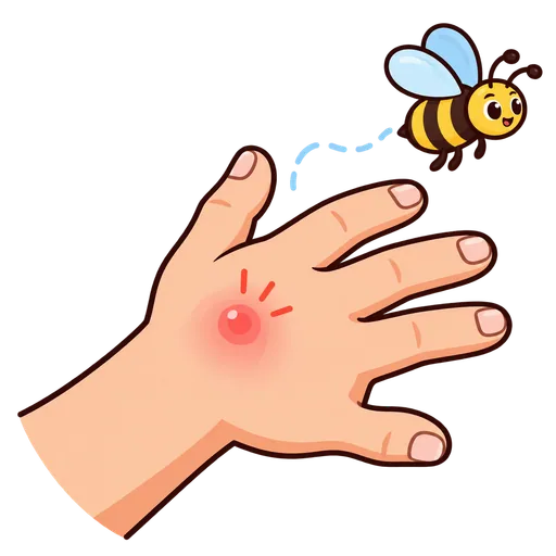 bee sting