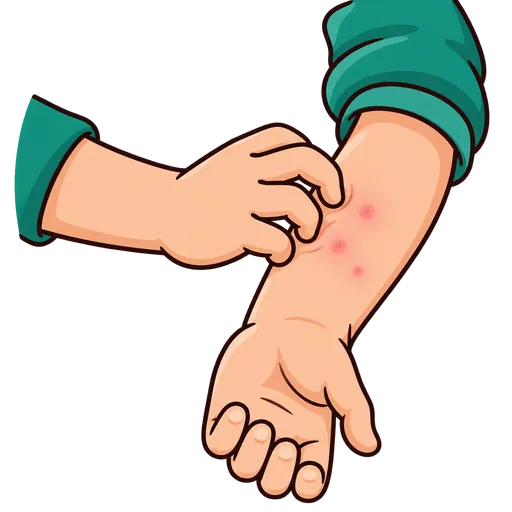 itching