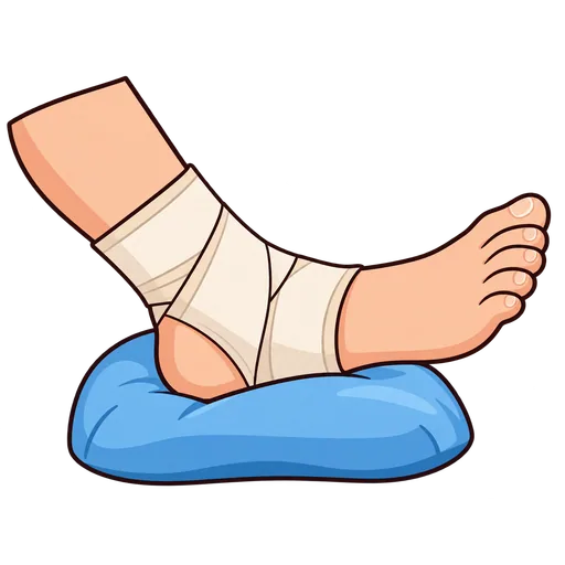 sprain